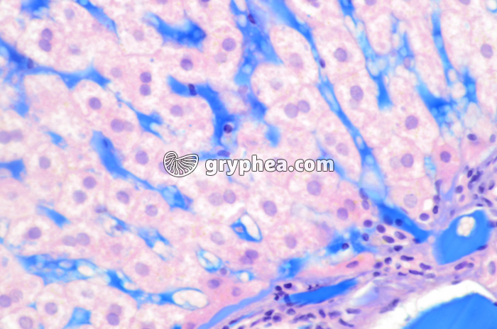 Foie injecté montrant les capillaires sanguins (sinusoïdes hépatiques) x100 - gryphea.org